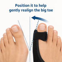 Infografik som visar hur en hallux valgus-nattskena hjälper till att rikta stortån mot en mer naturlig position för ökat stöd och avlastning.