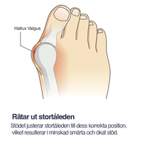 Corrigerende hallux valgus-steun met teenspreider (2-pack)