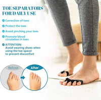 Teenspreider van silicone tegen hallux valgus (2-pack)