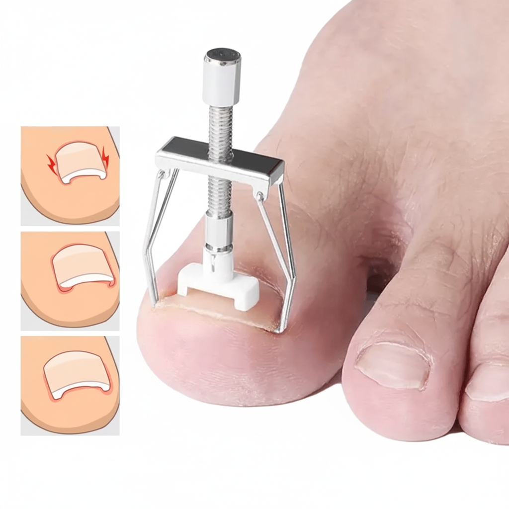 Instrument voor ingegroeide nagels met verend hefmechanisme