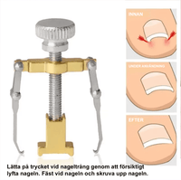 Instrument voor ingegroeide nagels met verend hefmechanisme
